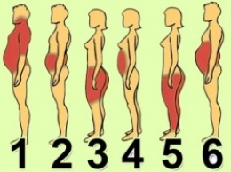 6 типов ожирения: о чем говорят лишние сантиметры на твоем теле