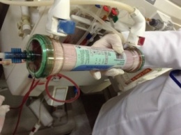 В больницах столицы разорвались гемодиализные системы от поставщика "Румед" - пациенты