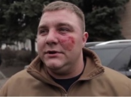 Мэр Белозерского подрался с толпой бойцов "Азова"
