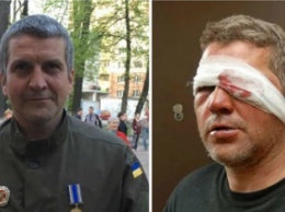 Запорожский боец сам устроил драку - полиция