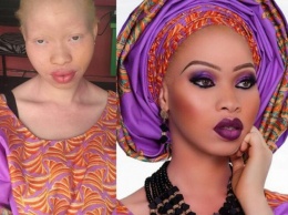 Визажисты до неузнаваемости преобразили девушку-альбиноса при помощи макияжа