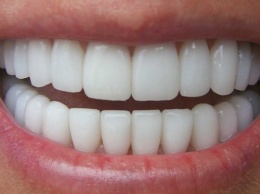 Ученые: Зубы человека отвечают за его сексуальное развитие
