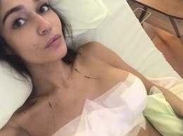 Алена Водонаева рассказала о причине уменьшения груди