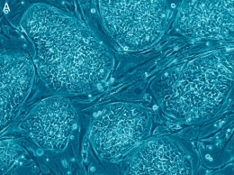 Ученым удалось омолодить стволовые клетки человека
