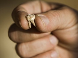 Ученые: Люди умели лечить зубные болезни еще 14 тыс лет назад