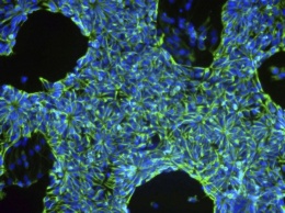 Ученые: Стволовые клетки начнут выпускать для лечения на фабриках