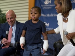 В США пересадили кисти рук восьмилетнему мальчику
