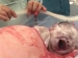 Все врачи открыли рты от того, КАК появился на свет этот малыш. Обратите внимание на его правую руку