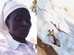 В Зимбабве женщина родила "лягушку"