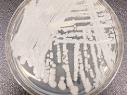 В США прогрессирует редкое заболевание грибковой инфекцией Candida auris