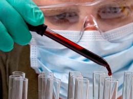 Ученые выяснили «самую сексуальную» группу крови