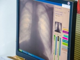Месячник борьбы с туберкулезом: где можно пройти флюорографию