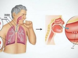 Как уменьшить кашель за один день?