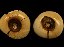 Найдена самая древняя зубная пломба