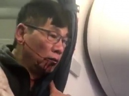 Одна из крупнейших авиакомпаний мира угодила в скандал после жестокого избиения пассажира, который не захотел покинуть самолет
