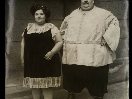 100 лет назад эта пара была самой толстой в мире. Вот как они выглядели!
