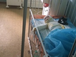В Одессе годовалую девочку родители "обварили" в кипятке и 16 дней лечили дома (ФОТО)