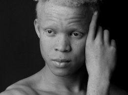 19-летний альбинос, сбежавший от колдунов, стал моделью