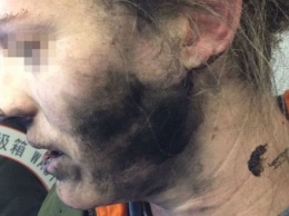 Apple назвала причину взрыва наушников на голове у пассажирки рейса Пекин-Мельбурн