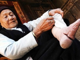 Эта старая китаянка показала, к чему приводит бинтование ступней согласно древней традиции. Кошмарное зрелище!