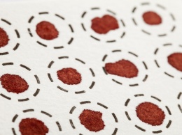Метод «сухой капли» расширит возможности анализа крови