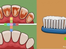 Как удалить зубной камень, очистить зубной налет и уничтожить бактерии с помощью всего только одного ингредиента!