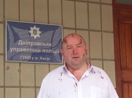 В Киеве жестоко избили правозащитника Александра Дядюка