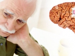 Ученые: В 2100 году каждый второй житель Земли заболеет синдромом Альцгеймера