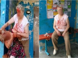 Две пенсионерки устроили кровавую драку в Житомире
