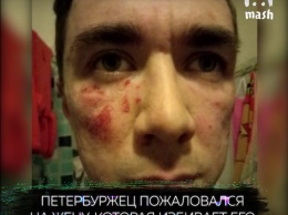 В Петербурге жена избила мужа за лайки чужих женщин в соцсетях