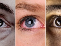 Быстрый анализ состояния здоровья по глазам. 12 признаков того, что есть проблемы