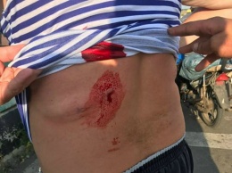 Около КПВВ Марьинка гражданский получил огнестрельное ранение
