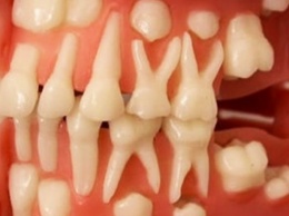 НОВОСТЬ ДНЯ! Стало возможным вырастить зубы станет в любом возрасте!