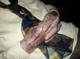 Вся ее рука была полностью покрыта этими коричневыми пятнами, но она знала, что с ними делать!