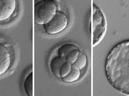 Ученые из США впервые успешно отредактировали геном эмбриона человека