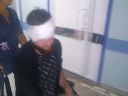 Как поступают с хунвейбинами: В Харькове сильно избит видный майданщик