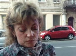 В центре Одессы злоумышленник избил известную активистку