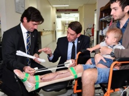 В Австралии впервые в мире имплантировали человеку напечатанную на 3D-принтере кость