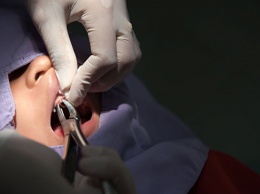 Ученые выяснили, почему мужчины боятся ходить к стоматологу