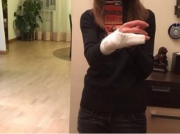 В Киеве женщине-водителю за отказ предъявить документы копы повредили пальцы. ФОТО
