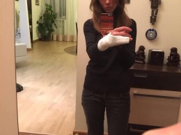 В Киеве коп сломал руку девушке, которая отказалась предъявлять права после нарушения ПДД
