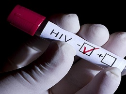 Запорожцев зовут бесплатно пройти быстрые тесты на ВИЧ