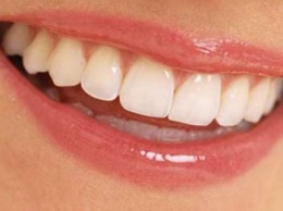 Врачи назвали простой, но эффективный способ отбеливания зубов дома