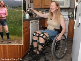 Женщина, которая может ходить, просит доктора парализовать ей ноги! Но зачем?