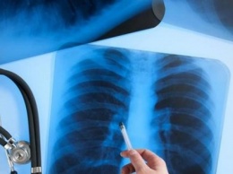 В Одесской области педиатр год работала с открытой формой туберкулеза (ВИДЕО)