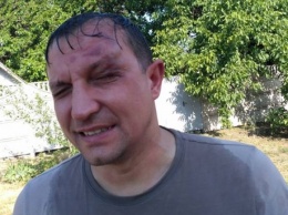 В Кривом Роге неизвестные напали на депутата, объявлен план "Перехват" (Фото)