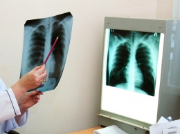 Российские исследователи изменили представление о диагностике туберкулеза