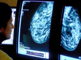 Ученые нашли способ предотвратить рак груди