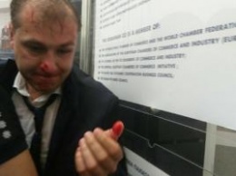 В Киеве националисты сорвали съезд политической партии и побили заместителя ее председателя