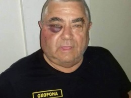 "А потом она потопталась на груди". Бывшая жена нардепа Геращенко заявила о нападении на нее в подъезде дома. Охранник утверждает, что это она его побила